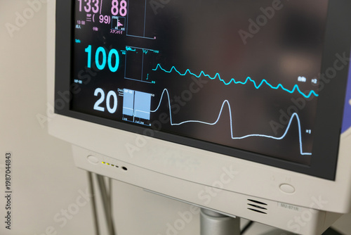 パソコンの画面に表示された心電図