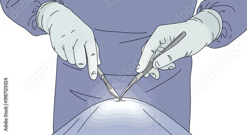 Surgical Scalpel Inc Vector Illustration Close-up of a Surgeon's Hands Performing a Delicate Incision with a Scalpel, symbolizing precision and medical procedures