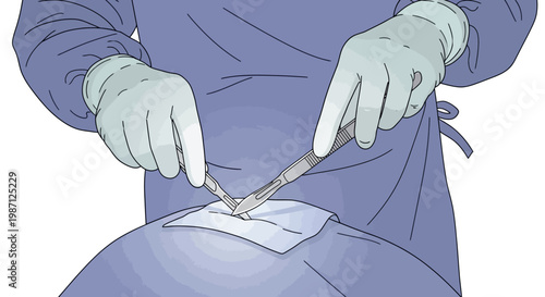 Surgical Procedure Vector Illustration Close-up of a Surgeon's Hands in Gloves Holding a Scalpel Over a Sterile Field