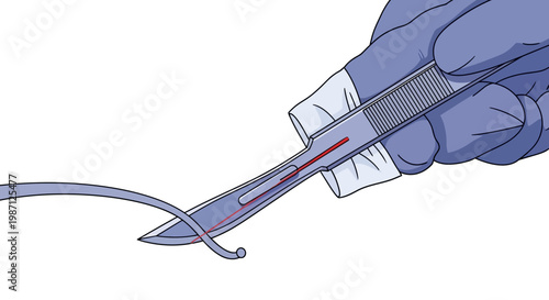 Close-up vector illustration of a surgeon's hand in a blue glove holding a surgical scalpel with a red thread, preparing for a procedure