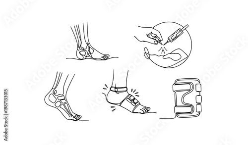 Minimal continuous line orthopedic injury icon set with joint injection leg fracture ankle sprain vector illustration
