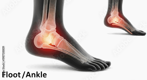 An illustration of two feet with highlighted ankle bones and red inflammation in white background.