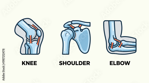 Human Joint Anatomy Vector Illustrations Detailed Knee, Shoulder, and Elbow Diagrams for Medical Education and Healthcare Content