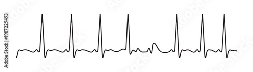 Heartbeat line ecg medical pulse trace illustration for cardiology health monitoring concepts in vector style.