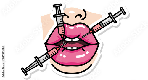 Lip Filler Injection Treatment Vector Illustration, Aesthetic Medicine Procedure Graphic for Cosmetic Surgery and Beauty Clinic Branding Concepts