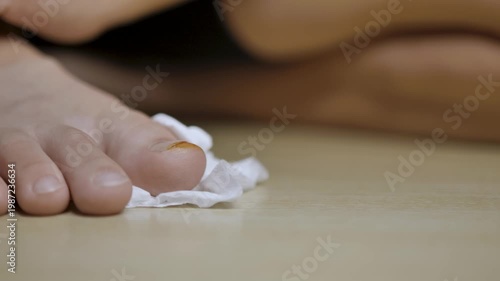 Close-up of a finger with a minor wound treated with antiseptic and tissue on a table. The image reflects first aid, wound care, hygiene, safety, and basic home medical treatment.