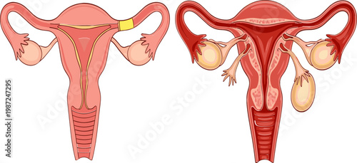 Female Reproductive System with Uterus, Ovaries, and Fallopian Tubes for Educational and Health-Related Illustrations