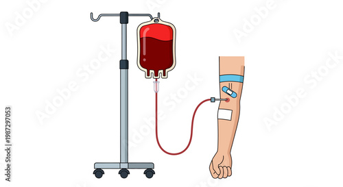 Life-Saving Blood Transfusion Intravenous Drip Delivering Vital Fluid to a Patient's Arm, Illustrating Healthcare and Support