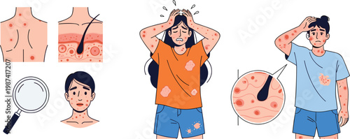 Skin Infection and Allergy Symptoms Set with Itching Rash Red Spots and Dermatology Condition for Healthcare Awareness Flat Vector Illustration