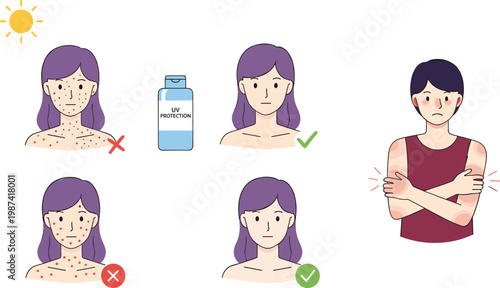Sun Protection and Skincare Concept Set with UV Damage Acne Prevention Sunscreen Application and Healthy Skin Routine Flat Vector Illustration