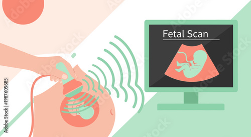 Pregnant Woman Undergoing Fetal Scan Ultrasound, Baby Image on Monitor
