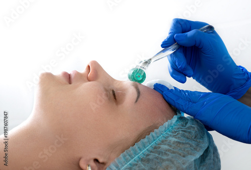 Quadro su tela Mesotherapy by microneedling