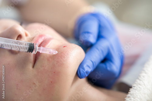 Tableau sur toile Mesotherapy
