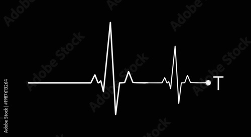 Graphic illustration of a white ekg line on a black background