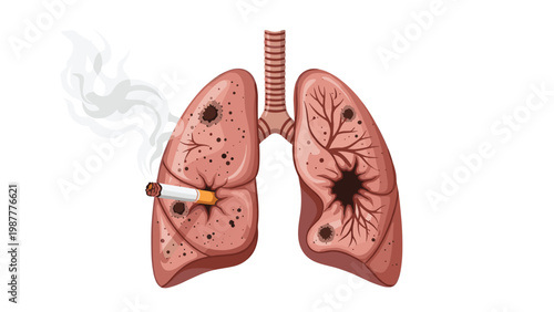 Detailed anatomical illustration of human lungs damaged by smoking showing dark spots, decay, and lit cigarette representing health risks.