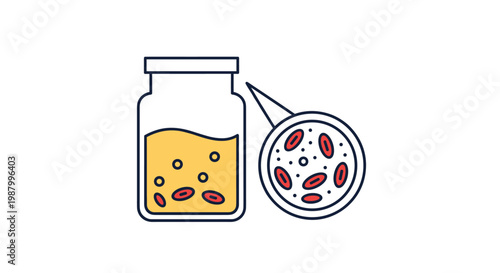 Medical diagnostic illustration features a laboratory sample jar filled with yellow liquid and a magnifying glass showing blood cell analysis.