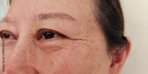 close up the swelling and ptosis, wrinkle and scar, Flabbiness and Flabby skin, freckles and blemish on the face, health care and beauty concept.
