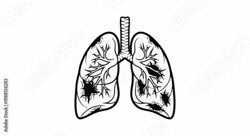 Illustration of damaged lungs with black patches on a white background