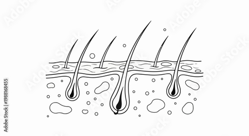 Cross-section of skin showing hair follicles and subcutaneous layer