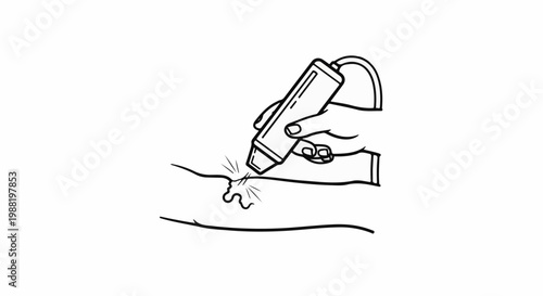 Line art of a hand using a device to treat a visible vein on an arm