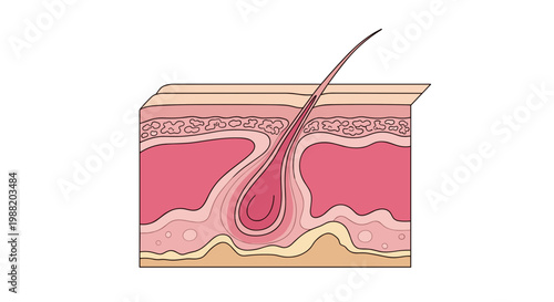 Detailed illustration of person skin cross-section with layers and hair follicle, highlighting peeling effects on a white background