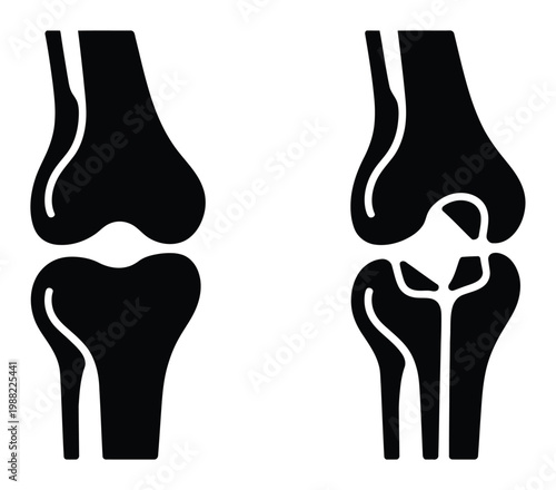 Comparison of Healthy and Arthritic Knee Joints: A Silhouette