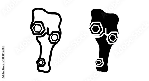 Orthopedic bone fracture fixation with screws and plate icon set