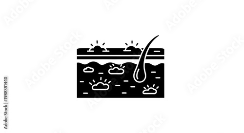 Illustration of Skin Layers with Hair Follicle and Sebaceous Glands