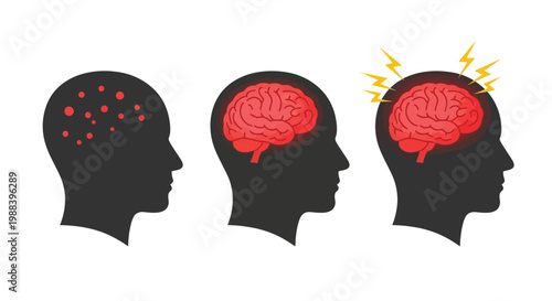 Illustrating stages of increasing neurological distress and brain activity