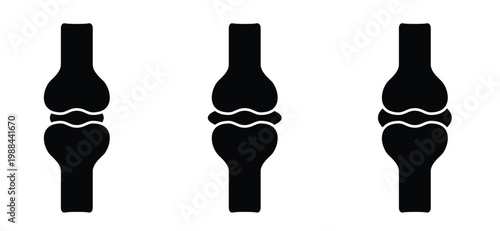 Structure of the knee joints. Cartoon knee bones. Bones icon set. Anatomy, human knee bone snatomy concept. Broken knee joint with pain. Bone joints. Science design.  Human leg.