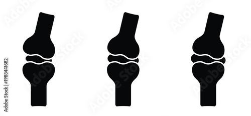 Structure of the knee joints. Cartoon knee bones. Bones icon set. Anatomy, human knee bone snatomy concept. Broken knee joint with pain. Bone joints. Science design.  Human leg.