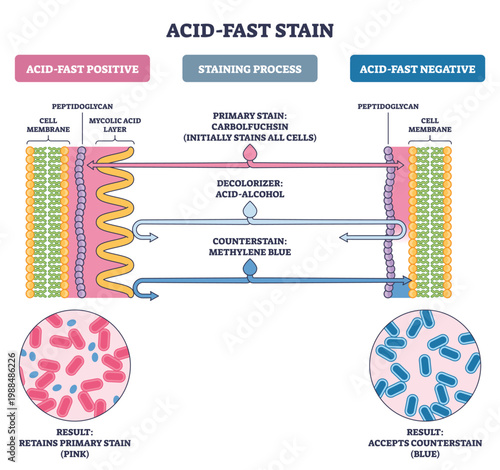 Acid-fast stain process compares positive vs negative cells, showing carbolfuchsin, acid-alcohol, methylene blue, key objects, mycolic acid layer, cell wall, bacilli. Outline diagram