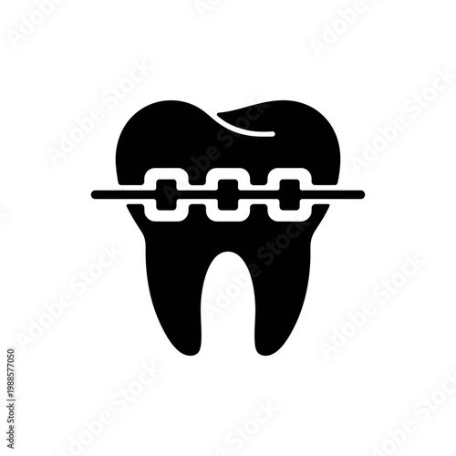 Stylized illustration of a single molar tooth with orthodontic braces applied for alignment correction