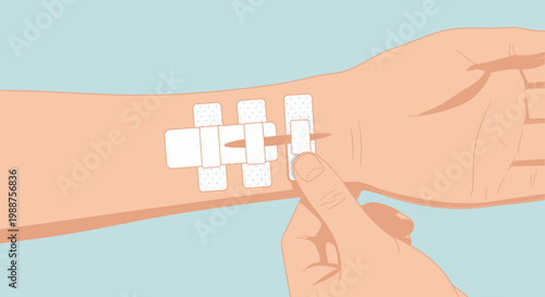 Applying bandages to a wound on a person's arm, close-up