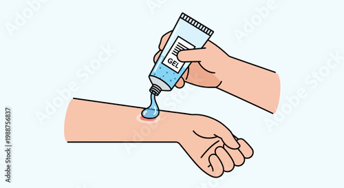 Applying cooling gel to a minor burn on a person's arm, first aid for skin injury