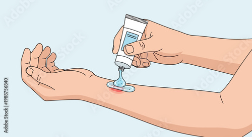 Applying soothing gel to a red, irritated skin patch on an arm, first aid concept