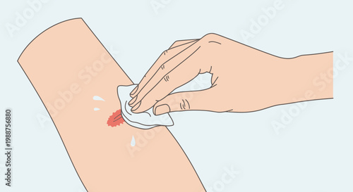 Cleaning a cut wound on arm with wet wipe, first aid, hygiene, medical care, skin injury