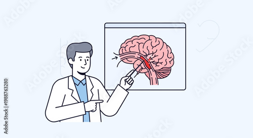 Doctor explaining brain stroke and blood clot in a medical presentation