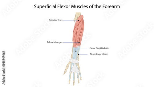Superficial Flexor Muscles of the Forearm
superficial anterior forearm muscles including pronator teres, palmaris longus, and wrist flexors.