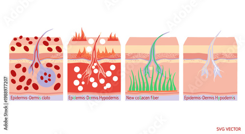 The skin layers diagram illustrates the epidermis and dermis in detail