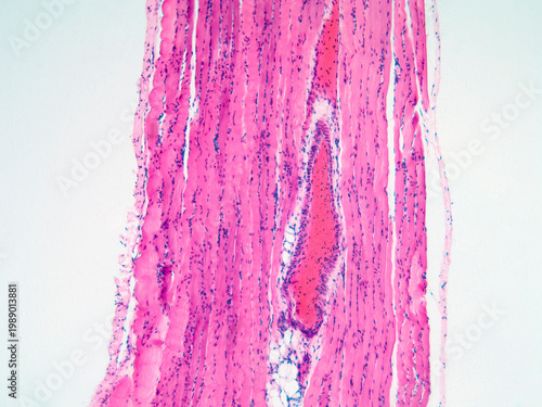 Striated Muscle Tissue Micrograph
