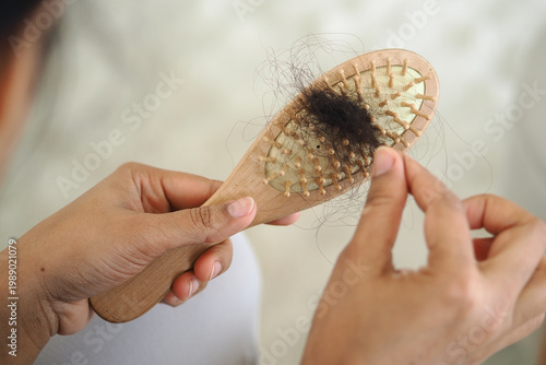 Obraz na plátně Holding a hairbrush with loose hair strands after brushing