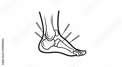 Anatomical illustration of a foot with acupuncture needles inserted