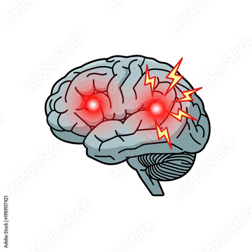 Illustration of a human brain experiencing pain or intense activity, with glowing red spots and lightning bolts.