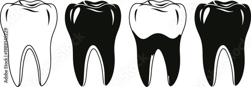 Dental illustration four tooth views depicting enamel dentin and pulp cavities