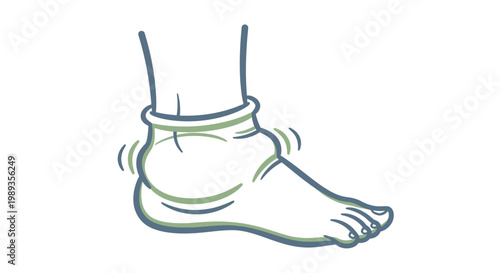 Illustration of a swollen human ankle showing inflammation and medical condition.