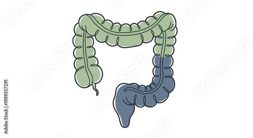 Anatomical illustration of human large intestine showing distinct colored sections.
