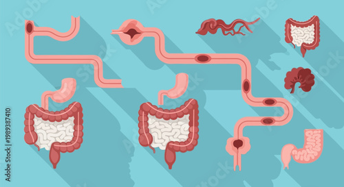 Digestive System Disorders and Diseases Illustration.