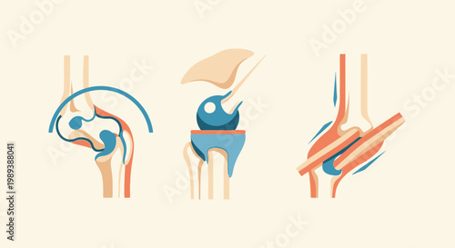 Human Joint Anatomy Illustration - Knee, Hip, and Elbow Joints.