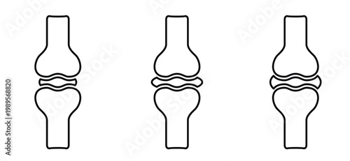 Structure of the knee joints. Cartoon knee bones. Bones icon set. Anatomy, human knee bone snatomy concept. Broken knee joint with pain. Bone joints. Science design. Human leg.